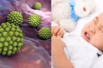 Virus Rota tấn công trẻ em toàn thế giới: BS chỉ ra 8 triệu chứng