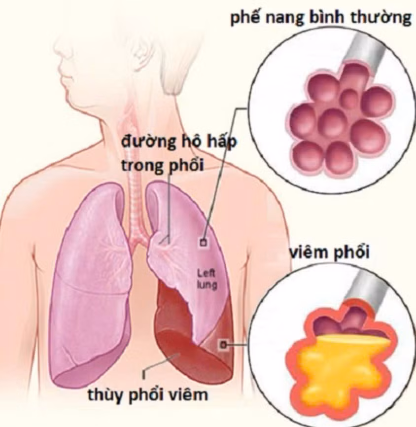 p1.jpg