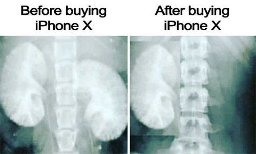 Cười đau ruột với những tấm ảnh chế iPhone X