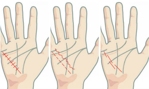 Xem đường chỉ tay biết ngay sức khỏe trọn đời 