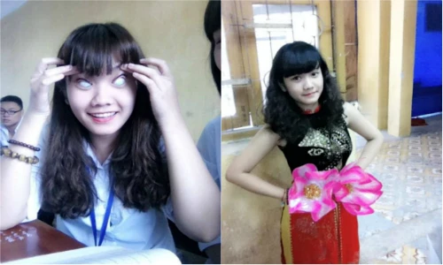 Nhan sắc nữ sinh bị chế giễu “cá mập cắn cáp quang“