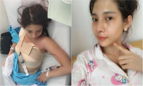 Gái trẻ khoe chiến tích phẫu thuật thẩm mỹ toàn thân