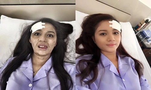 Hoa hậu xinh đẹp hóa bà già nhăn nheo gây sốt mạng