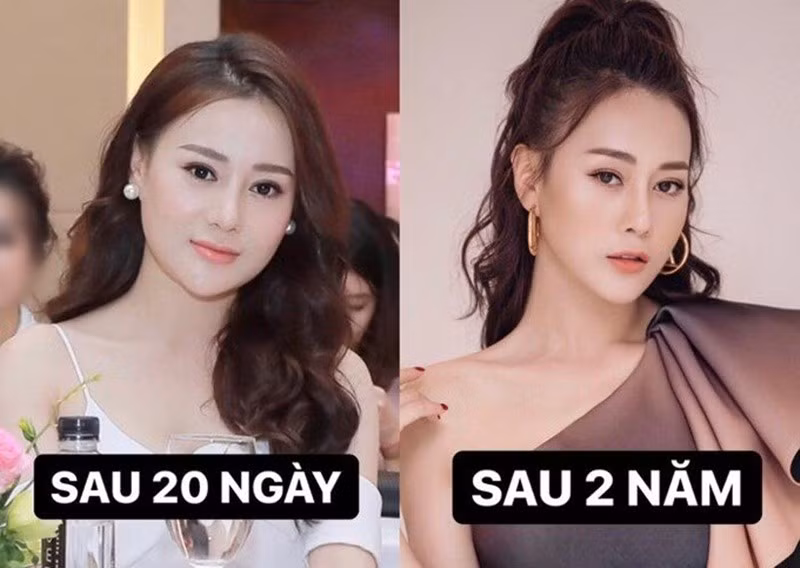 Phương Oanh từng chia sẻ trên Vietnamnet, cô không lạm dụng dao kéo, cũng không quá đà cũng như chạy theo những xu hướng không phù hợp với khuôn mặt hay tính cách của mình. Ảnh: Người Đưa Tin.