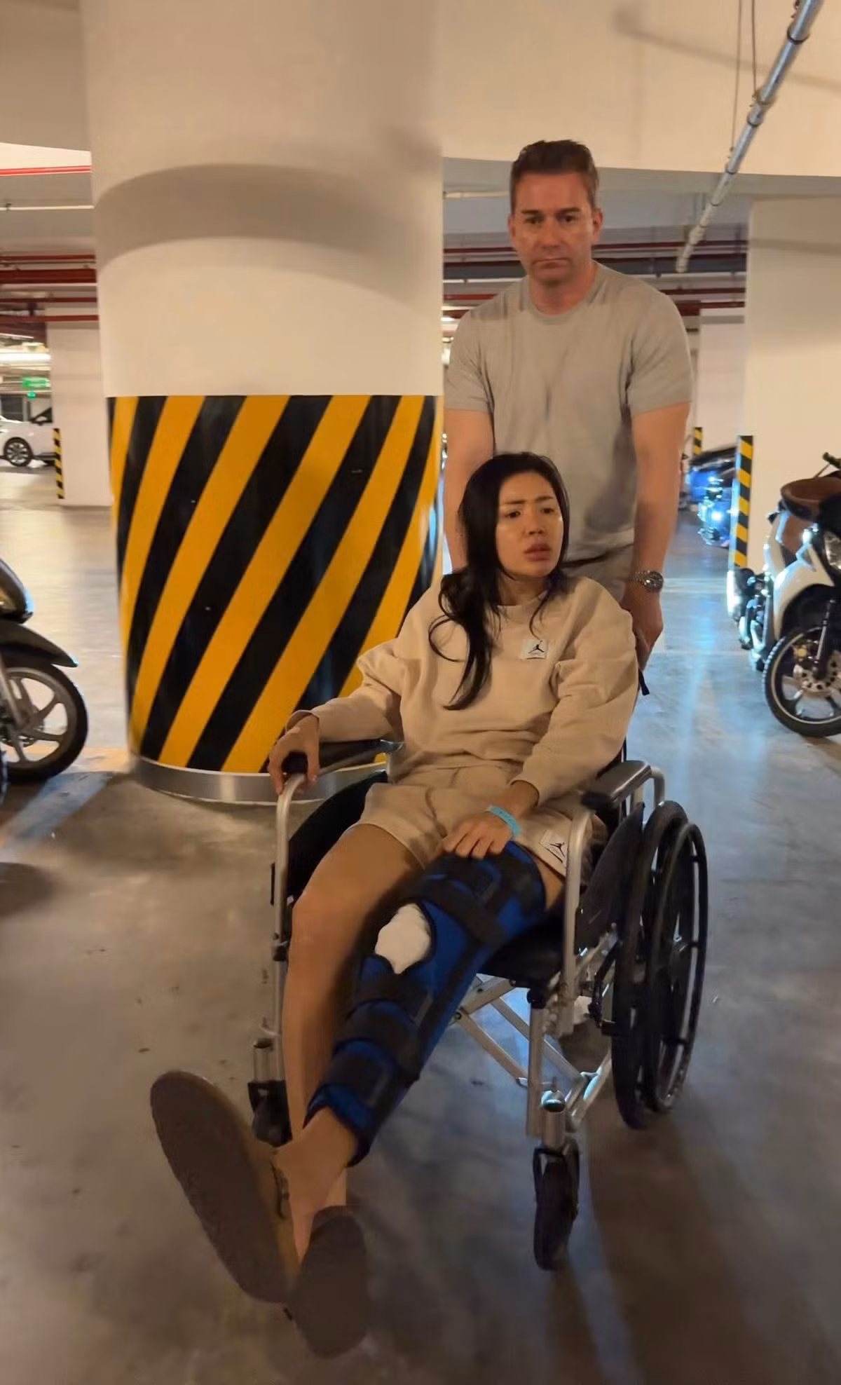 Nữ người mẫu trải qua ca mổ sau khi bị đứt hoàn toàn dây chằng chéo trước, rách sụn chêm và dập xương.