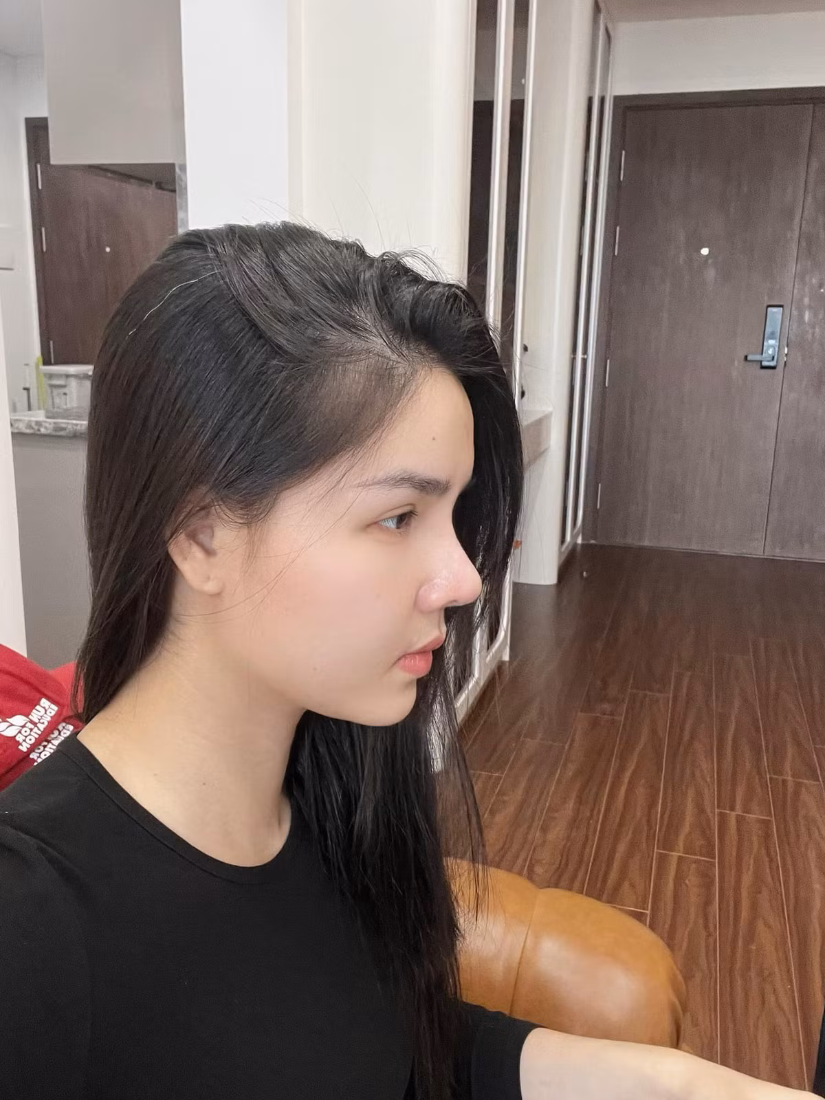 Thời gian qua Kỳ Hân gây chú ý khi khoe sửa mũi và hình ảnh gương mặt sau thẩm mỹ. Ảnh: FBNV