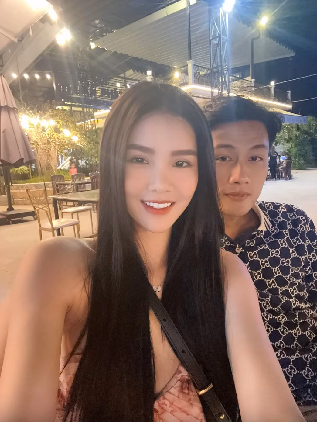 Kỳ Hân cũng cho biết, hiện tại cô hài lòng với nhan sắc, vóc dáng, ngoại trừ phẫn mũi chưa được hoàn thiện hoàn toàn. Ảnh: FBNV