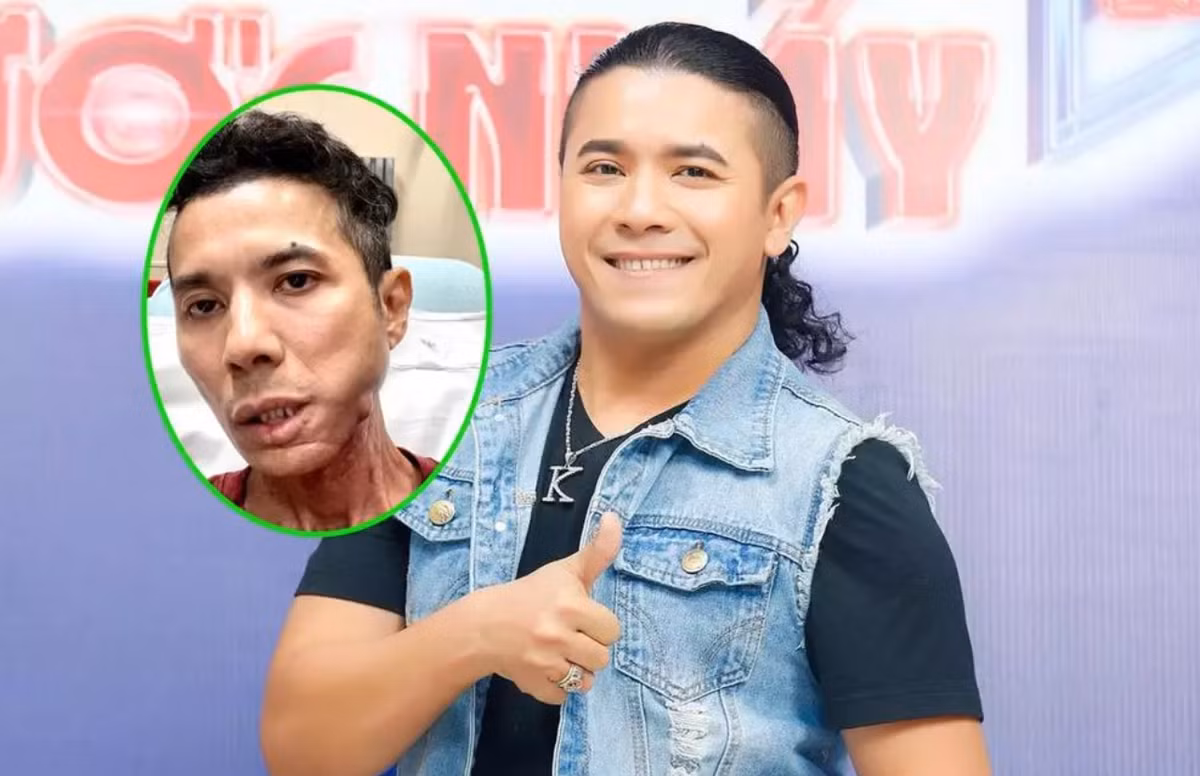 Kasim Hoang Vu benh tinh dang lo, chi phi dieu tri dat do-Hinh-2