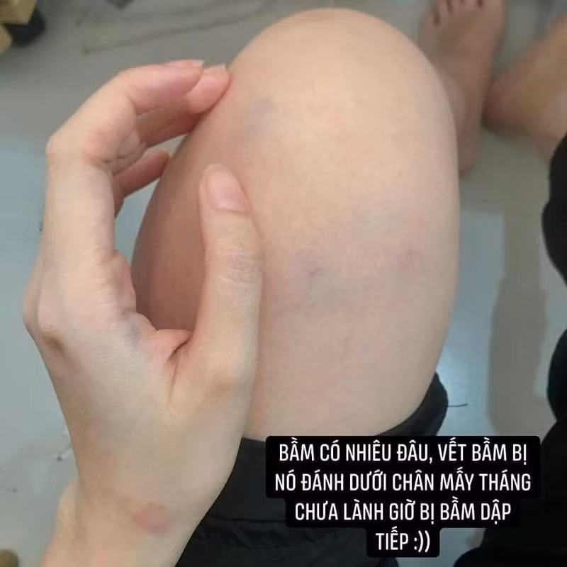 Trai la tha tim, co gai bi nguoi yeu danh gay buc xuc-Hinh-4