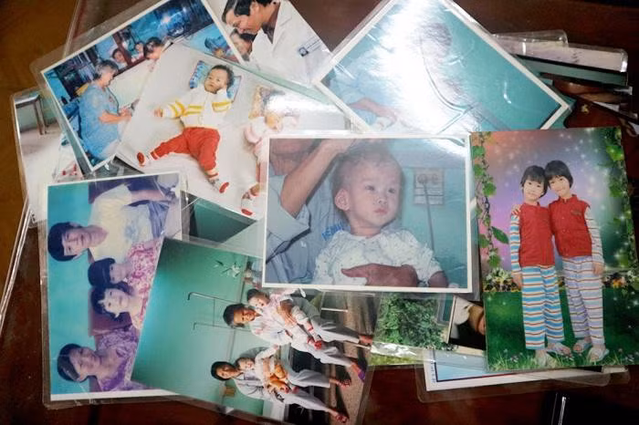 Cặp song sinh Cúc - An sau 17 năm mổ tách rời giờ ra sao? - Hình 2 Cap song sinh Cuc - An sau 17 nam mo tach roi gio ra sao?-Hinh-2