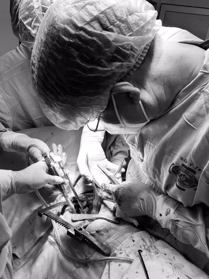 Đau tức nhẹ khi vận động cánh tay không ngờ u xương sườn - Hình 3 Dau tuc nhe khi van dong canh tay khong ngo u xuong suon-Hinh-3