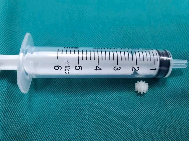 Nhiều trẻ hóc dị vật nhập viện, chuyên gia chỉ cách xử lý đúng - Hình 2 Nhieu tre hoc di vat nhap vien, chuyen gia chi cach xu ly dung-Hinh-2