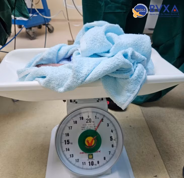 Cứu cặp song sinh mắc hội chứng truyền máu song thai - Hình 3 Cuu cap song sinh mac hoi chung truyen mau song thai-Hinh-3