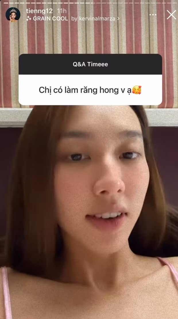 Mới đây, thông tin Thùy Tiên hé lộ chuyện từng "dao kéo" một điểm trên gương mặt để hút hồn, thần thái hơn đã khiến nhiều cư dân mạng chú ý.