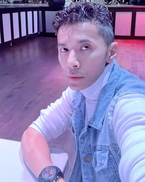 Nam ca sĩ ăn ít hơn trước và chỉ ăn đồ mềm sau ca phẫu thuật nên cơ hàm không hoạt động nhiều khiến ngoại hình trở nên gầy gò. Ảnh: FB Kasim Hoàng Vũ.