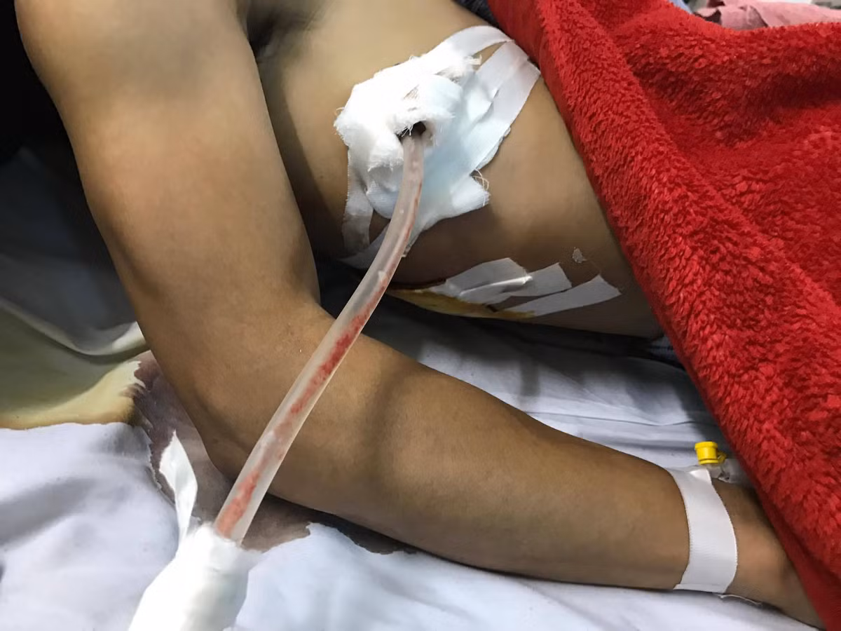 Trieu tap nghi pham dam trong thuong nguoi cuu co gai bi tai nan-Hinh-3