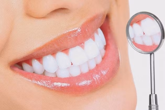 Phương pháp bọc răng sứ giúp khắc phục hiệu quả tình trạng răng bị sứt mẻ, gãy vỡ, hô móm nhẹ, vàng ố,...Ảnh: vatgia.