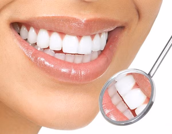 Bọc răng sứ có lẽ là phương pháp thẩm mỹ răng đang được nhiều người, cả nam giới và nữ giới ưa chuộng nhất hiện nay. Ảnh: nhakhoanucuoiduyen.