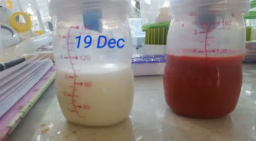 Bức ảnh sữa mẹ màu đỏ của Tanya. Ảnh: NVCC. Bức ảnh sữa mẹ màu đỏ của Tanya. Ảnh: NVCC.