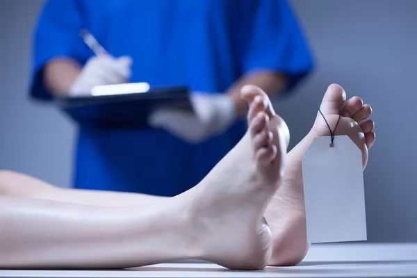 Tiếp đến, các cơ trên gương mặt người chết sẽ giãn ra. Hiện tượng giãn cơ xảy ra sẽ làm biến mất của những nếp nhăn ở trán, hốc mắt hay ở hai má. Theo đó, da mặt của người quá cố sẽ trở nên căng và bóng hơn.
