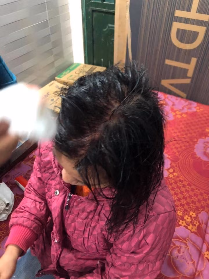 Vo di lam toc don Tet mat 500 ngan, bi chong danh tham te-Hinh-2