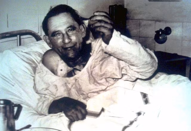 Louis Washkansky - bệnh nhân đầu tiên trong lịch sử thế giới thực hiện ghép tim năm 1967.