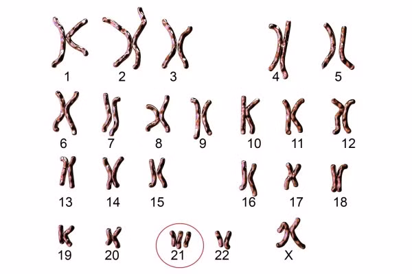 Bà vô cùng bất ngờ khi đọc được thông tin về việc phát hiện nhiễm sắc thể số 21 được đăng tải 6 tháng sau đó với tên của Jerome Lejeune đứng đầu và sau đó là tên bà nhưng sai chính tả. Phải đến năm 1994, ủy ban đạo đức của viện nghiên cứu y khoa INSERM (Pháp) nhận định Lejeune nhiều khả năng không đóng vai trò "chi phối" trong phát hiện này.