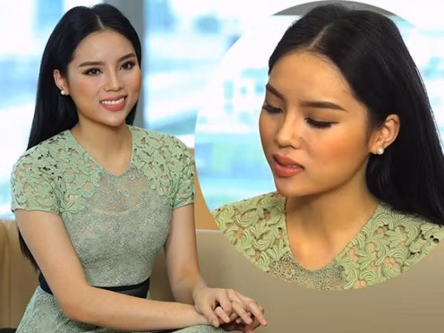 Cô cho biết rằng mình vừa bị sốt nên gương mặt bị sưng. 