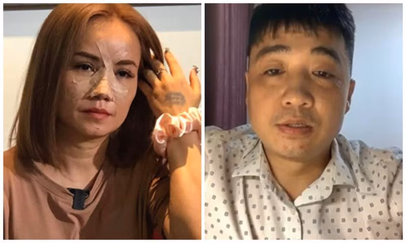  Chồng cũ livestream nói lý do đấm gãy mũi Hoàng Yến: Anh Cao Thắng gửi lời xin lỗi đến diễn viên Hoàng Yến vì đã đấm gãy mũi của cô và nhận lỗi. “Tôi biết mình sai rồi. Tôi sẵn sàng đối diện với pháp luật” - Cao Thắng nói và nêu lý do hành hung là có nhiều xích mích với nữ diễn viên "Về nhà đi con".