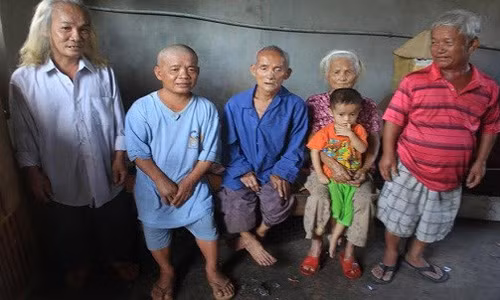 Kỳ lạ gia đình lùn nhất Việt Nam 4 đời không thoát "lời nguyền" Ky la gia dinh lun nhat Viet Nam 4 doi khong thoat