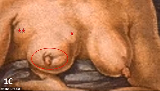 Michelangelo không chỉ tạo ra các tác phẩm nghệ thuật với ý nghĩa tôn giáo và triết học mà còn gửi gắm kiến thức y học. Michelangelo đã học về giải phẫu từ năm 17 tuổi và có thể đã gặp bệnh nhân ung thư vú, điều này ám ảnh ông suốt đời. (Ảnh: The Breast)