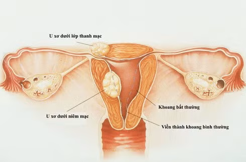 Kinh nguyet bat thuong, co the ban dang gap phai nhung van de nguy cap nay-Hinh-3