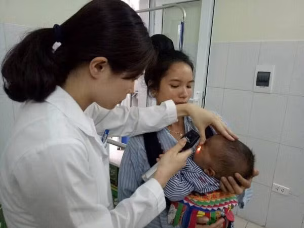 Bác sĩ khám mắt cho bệnh nhi. (Ảnh: Internet)