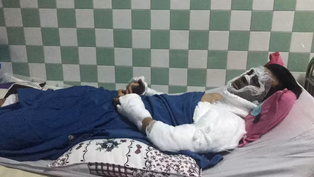 Vu 2 Viet kieu bi tat axit, cat gan chan: Nghi can tron ra nuoc ngoai xu ly the nao?