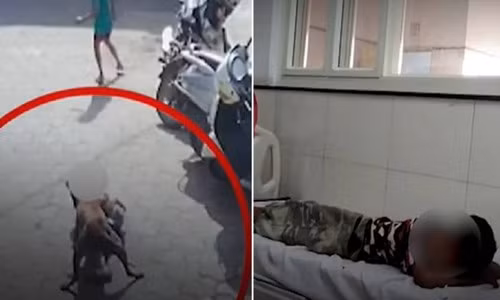 Rùng mình bé gái bị chó hoang lao vào cắn xé giữa đường Rung minh be gai bi cho hoang lao vao can xe giua duong