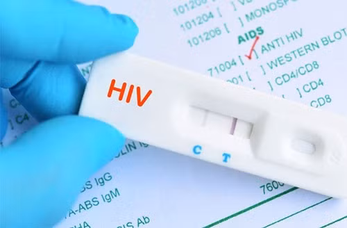Tuong nhiem HIV suy sup suyt chet, 5 nam sau biet xet nghiem nham