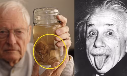 Khi còn sống, thiên tài vật lý Einstein bày tỏ nguyện vọng muốn được hỏa táng sau khi qua đời. Tuy nhiên, sau khi Einstein qua đời ở bệnh viện Princeton, bang New Jersey, Mỹ ngày 18/4/1955, nhà nghiên cứu bệnh học Thomas Harvey được cho là người đã đánh cắp bộ não của ông và đem thái lát nó. Hiện Bảo tàng Mutter ở Philadelphia, bang Pennsylvania là nơi duy nhất trên thế giới trưng bày các lát não của Einstein. bên trái ảnh là ông Harvey đang cầm lọ đựng mẫu não Einstein (bên phải ảnh) năm 1994.