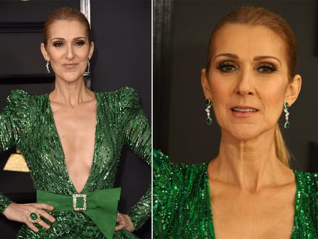 Nhìn Celine Dion như bà lão 60 chứ không ai nghĩ cô mới 48 tuổi.