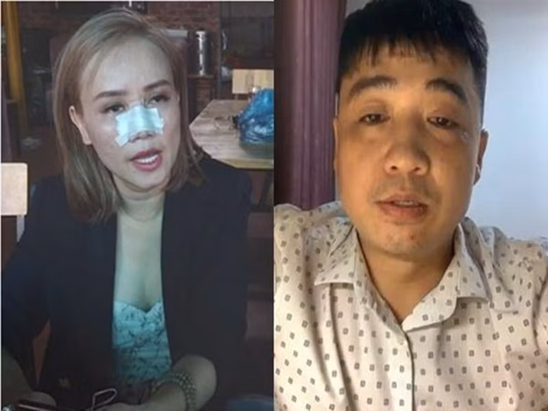 Năm 2021, Hoàng Yến bị chồng cũ Cao Thắng đấm chảy máu mũi, dùng dao đe dọa tại một quán ăn. Nữ diễn viên nhờ pháp luật can thiệp. Ngoài ra, Hoàng Yến không ngại công khai góc khuất hôn nhân với chồng cũ như bị chồng cũ bạo hành nhiều lần. Ảnh: Vietnamnet