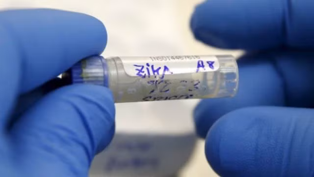 Bộ Y tế khuyến cáo triệu chứng phải xét nghiệm Zika Bo Y te khuyen cao trieu chung phai xet nghiem Zika