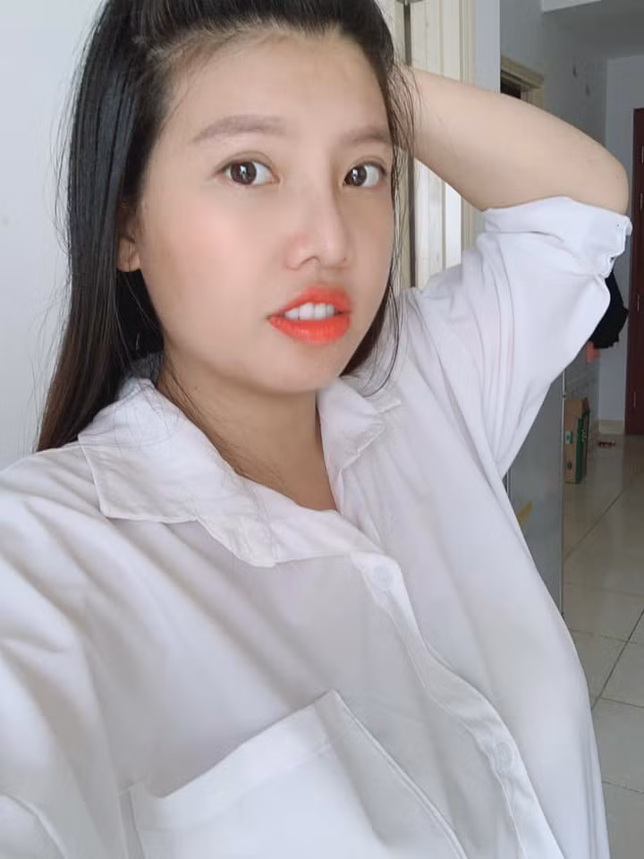 Cách đây 5 năm, Quách Phượng gây xôn xao mạng xã hội khi công khai hình ảnh của bản thân trước và sau phẫu thuật thẩm mỹ.