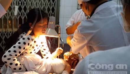 Thuong tam be trai 13 thang tuoi chay nhu duoc vi bong xang