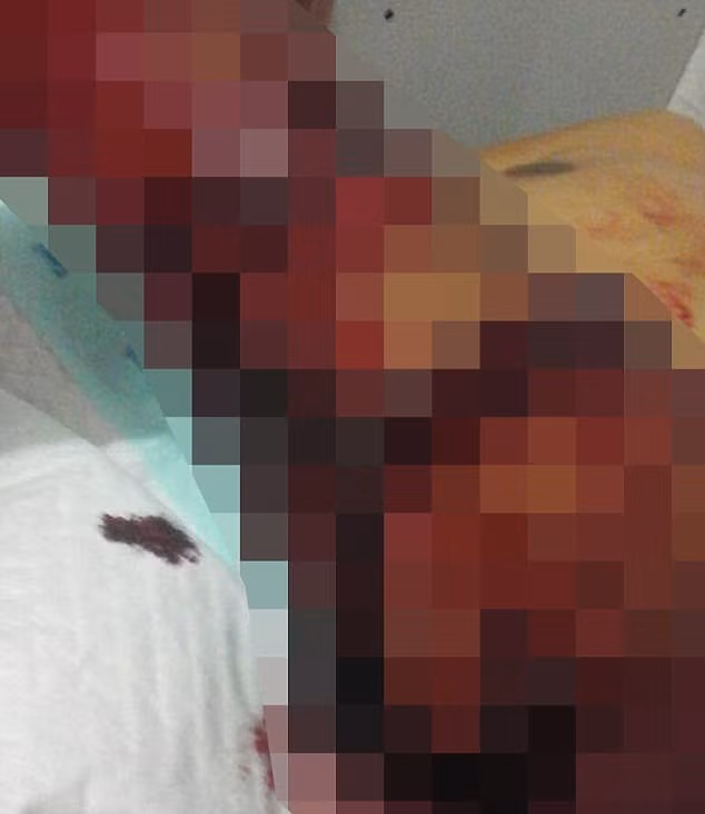 Tu chien tran khong lo 7m, nguoi dan ong lam duoc dieu khong tuong-Hinh-3