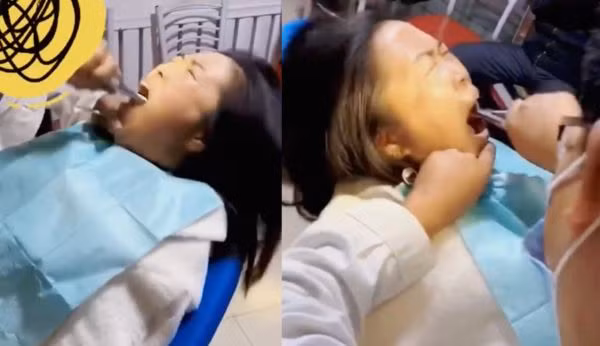 Nhổ răng khôn, bác sĩ khiến ai cũng hết hồn vì hành động này Nho rang khon, bac si khien ai cung het hon vi hanh dong nay