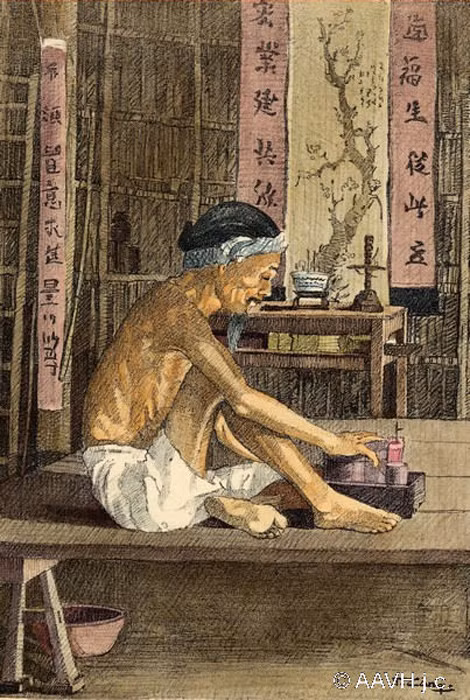 Một quý ông ngồi nghỉ trong nhà mình. Ảnh: Aavh.org.