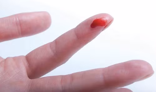 Người mắc chứng rối loạn đông máu không mất máu đến chết vì vết cắt nhỏ. Ở một số nơi, người ta cảnh báo bệnh nhân mắc chứng rối loạn đông máu không nên cầm nắm những vật sắc nhọn, kể cả gai hoa hồng cũng có thể làm họ mất máu nguy hiểm tính mạng. Tuy nhiên, những vết thương nhỏ không thực sự nguy hiểm tới vậy. Vết thương ở cơ quan nội tạng, vết bầm tím hoặc chấn thương gây chảy máu mới thực sự đáng sợ.