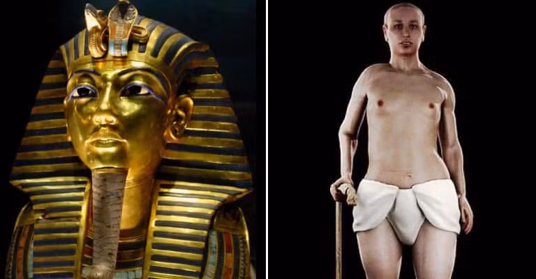 Kết quả phân tích xác ướp Tutankhamun của các chuyên gia chỉ ra pharaoh Ai Cập này có hàm răng hô, khuôn mặt lệch, một bàn chân bị vẹo, hông dị tật và mắc bệnh động kinh. Những dị tật này là do bố mẹ của Tutankhamun kết hôn cận huyết.