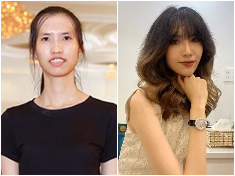 Hồng Xuân Next Top trở nên xinh đẹp hơn rất nhiều sau quá trình gần như “đập đi làm lại”. Ảnh: Dân Việt, FBNV
