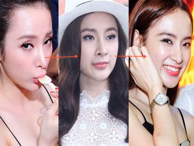 "Bà mẹ nhí" bị nghi chịu biến chứng phẫu thẩm mỹ. Ảnh: Sức khỏe và đời sống