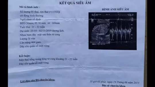 Be gai chua tron 14 tuoi mang thai 6 thang: Cong an vao cuoc